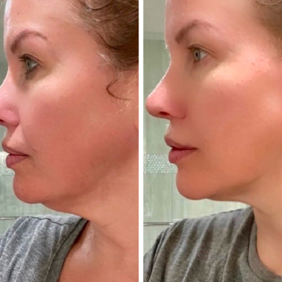 Resultados del masaje facial