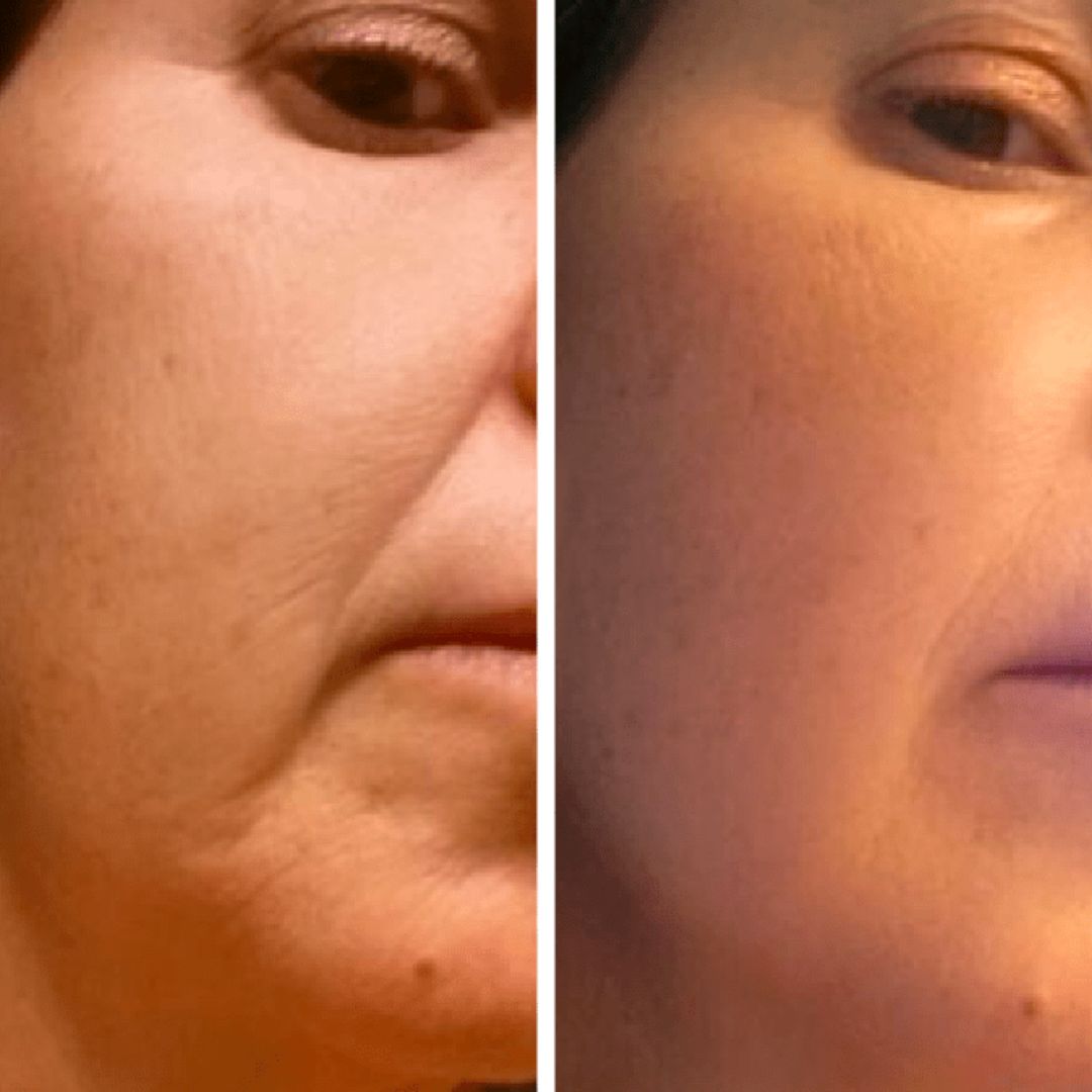 Técnica de masaje facial con gua sha