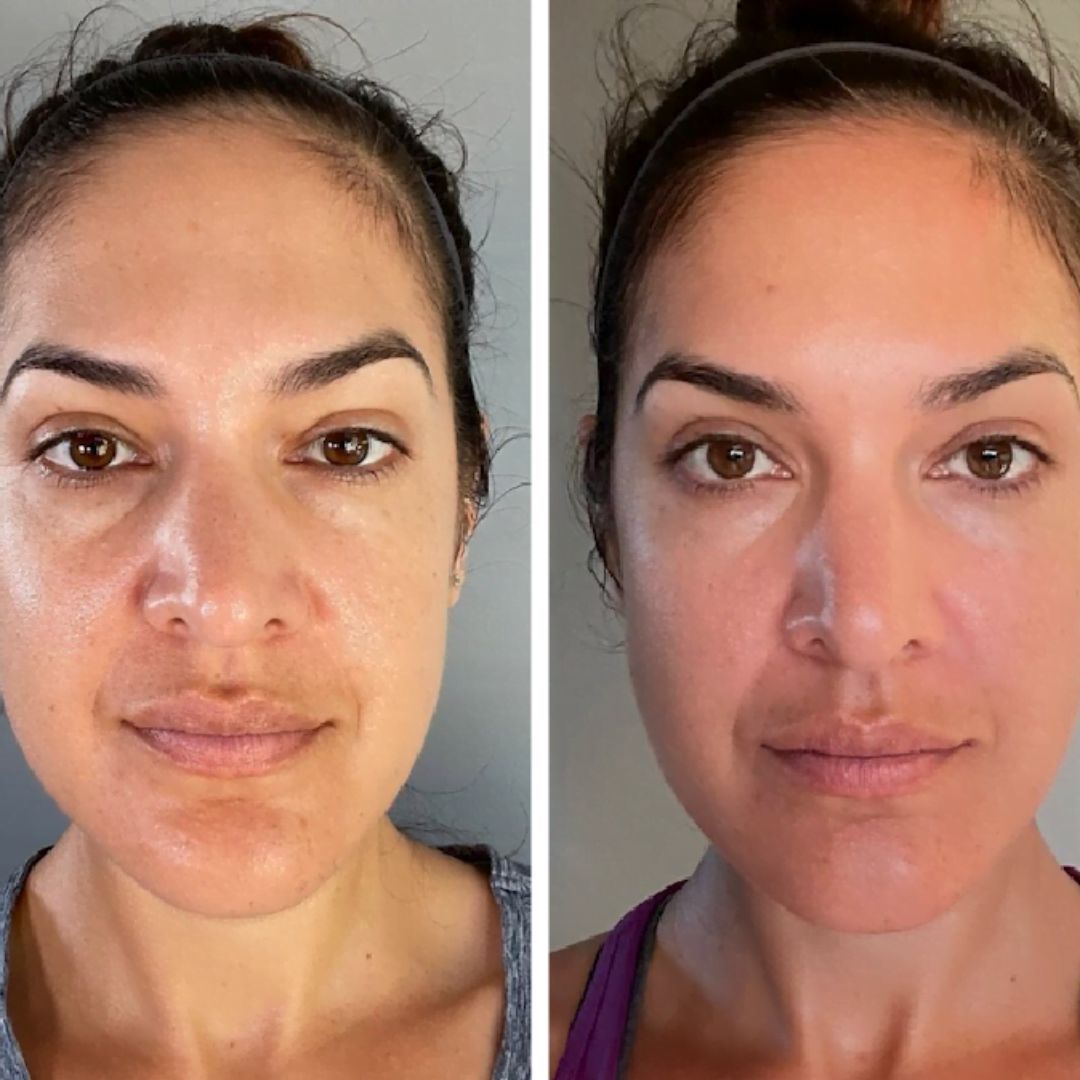 Beneficios del gua sha